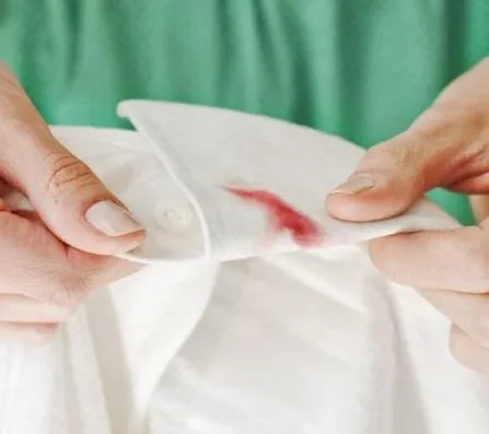 limpiar la sangre de la ropa