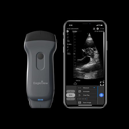 EagleView Ultrasound Scanner es un avanzado accesorio médico EagleView Wireless Probe Type Ultrasound Scanner