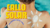 Callo solar: por qué es tan peligroso este reto viral